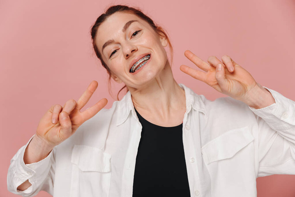 Modern happy smiling woman with braces showing peace on pink background - Fotoğraf, Görsel