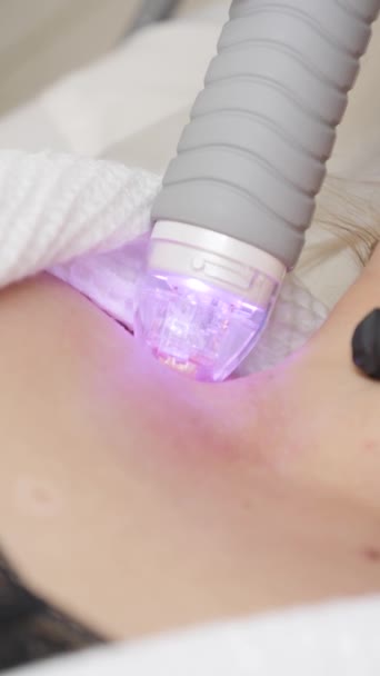 kosmetolog provádí RF zákrok na ženském krku - Záběry, video