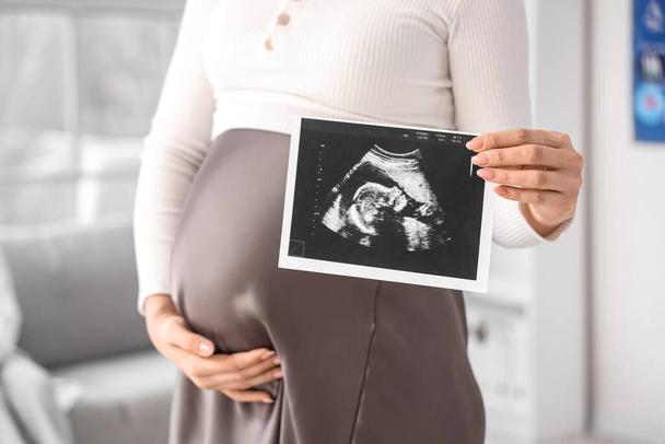Mujer embarazada joven con imagen de ecografía en la clínica, primer plano - Foto, imagen