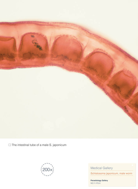Schistosoma japonicum on loinen, joka aiheuttaa ihmisen skistosomiaasia ja on pääasiassa yleinen Aasiassa, aiheuttaen vahinkoa ihmisen maksa- ja porttilaskimojärjestelmälle.. - Valokuva, kuva