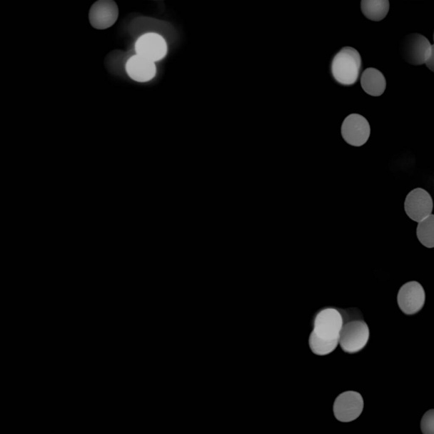 elmosódott körök bokeh fekete háttér - Fotó, kép