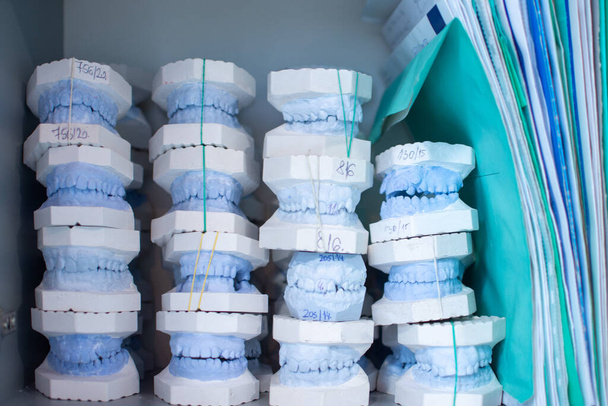 Стоматологические гипсовые модели челюстей в кабинете стоматолога - Фото, изображение
