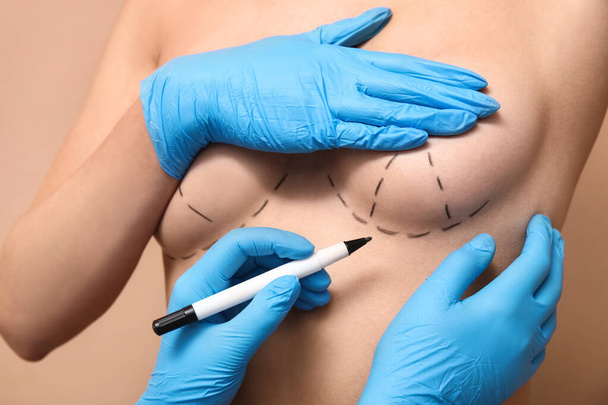 Arzt zeichnet vor Schönheitschirurgie vor braunem Hintergrund Markierungen an weiblicher Brust - Foto, Bild