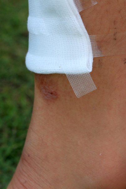 Venda adhesiva médica en la pierna
 - Foto, Imagen