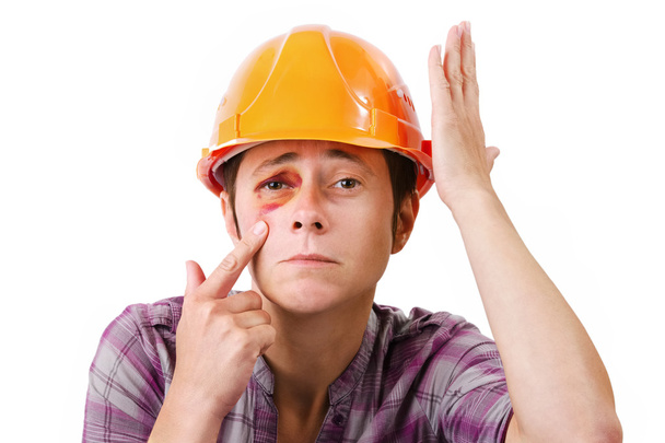 Female worker with a black eye in the helmet - Foto, afbeelding