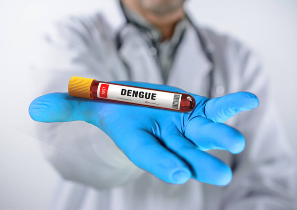 Échantillon de sang positif au test de dépistage du virus de la dengue - Photo, image
