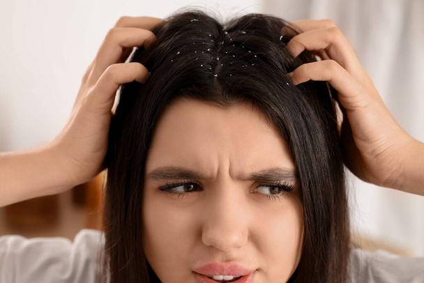 zestresowana młoda kobieta z łupieżem problem drapanie głowy w jasnej łazience - Zdjęcie, obraz