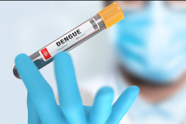 Muestra de sangre positiva con la prueba del virus del dengue - Foto, imagen