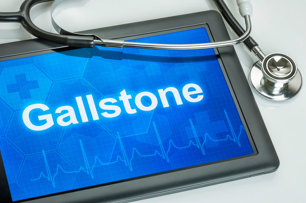 Tablet mit der Diagnose Gallenstein auf dem Display - Foto, Bild
