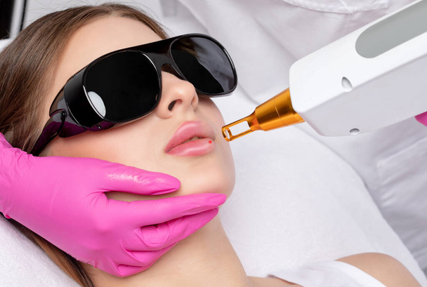 Verwijdering van permanente make-up op de lippen van een vrouwen.Carbon face peeling in een schoonheidssalon. Cosmetologische behandeling van hardware. - Foto, afbeelding