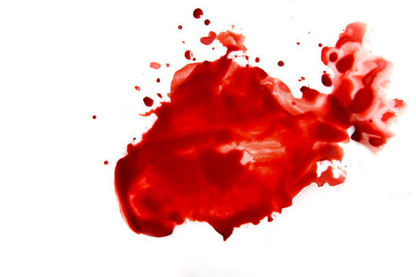 Blood smear splatter - Foto, afbeelding