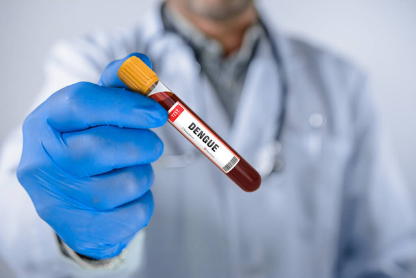 Blutprobe mit Dengue-Virus-Test positiv - Foto, Bild