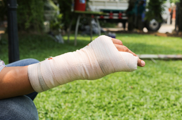 Sín-törött csont keze sérült - Fotó, kép