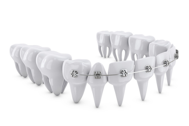 suportes dentários
 - Foto, Imagem