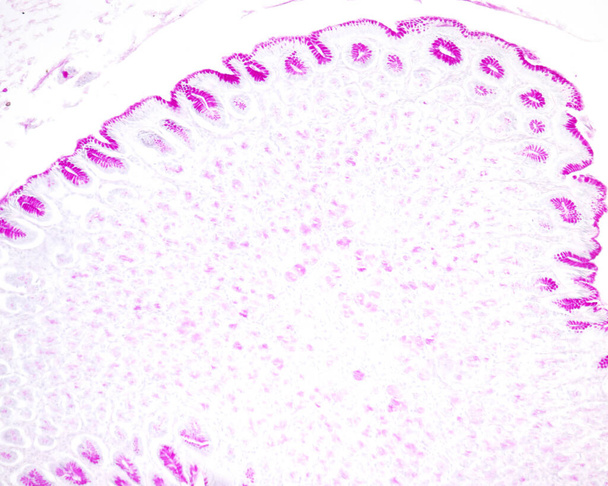 Световые микроскопы желудочной слизистой оболочки окрашены методом PAS. Слизистый поверхностный эпителий и ямчатые клетки желудка показывают большую положительную реакцию PAS, потому что они являются слизистыми клетками типа. - Фото, изображение