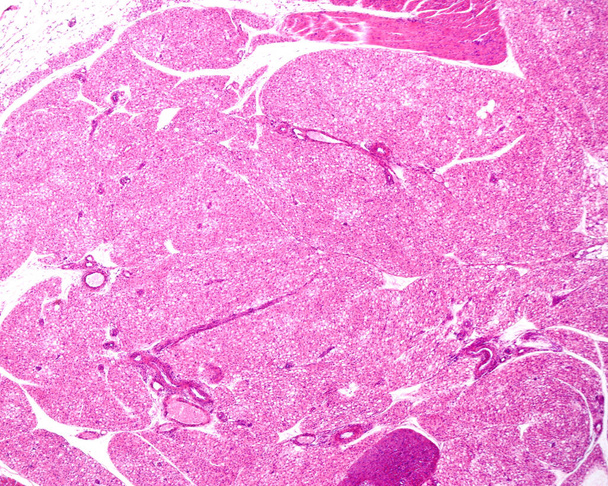 Nagyon alacsony nagyítású fénymikrográf interscapularis barna zsírszövetet mutat. Barna zsír nagyon fejlett rágcsálók és hibernált állatok. Barna adipociták mutatnak szivacsos eozinofil szempontból, mert tárolt zsír, mint a kis lipid cseppek. - Fotó, kép