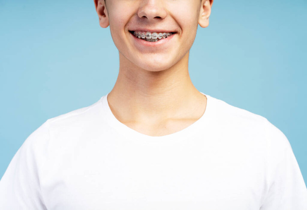 Guapo chico excitado con ortodoncia frenos de pie aislado sobre fondo azul, primer plano. Concepto de odontología, tratamiento - Foto, imagen