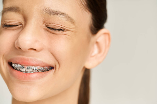 Ένα κομψό έφηβο κορίτσι με σιδεράκια στα δόντια της χαμογελά έντονα, αποπνέοντας αυτοπεποίθηση και γοητεία. - Φωτογραφία, εικόνα