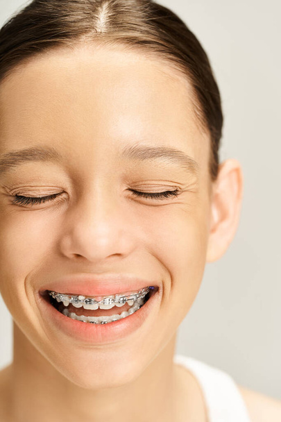 Una adolescente con estilo sonriendo con confianza con aparatos ortopédicos en los dientes, mostrando su viaje a una sonrisa hermosa y saludable. - Foto, Imagen