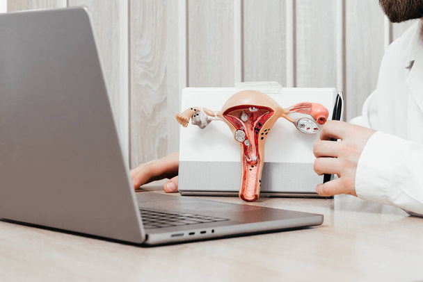 Un médico ginecólogo sostiene un modelo del útero y los ovarios. Cáncer de ovario y cuello uterino, trastorno cervical, endometriosis, histerectomía, fibromas uterinos, sistema reproductivo y concepto de embarazo. - Foto, Imagen