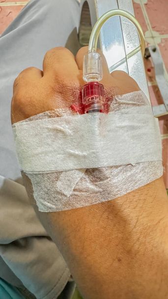 Primo piano della mano di un vero paziente con infusione endovenosa. (IV) concetto di trasfusione di sangue - Foto, immagini