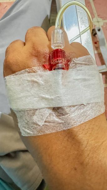 Primer plano de la mano de un paciente real con perfusión intravenosa. IV) concepto de transfusión de sangre - Foto, imagen