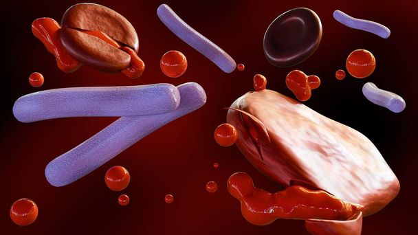 3d рендеринг септицемии, или сепсис, клиническое название для заражения крови Klebsiella spp. бактерии. - Фото, изображение