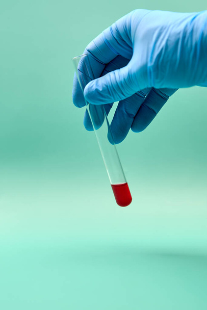 Mão de um médico anónimo com um tubo de ensaio contendo uma amostra de sangue. - Foto, Imagem