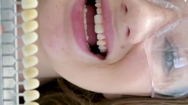bělení zubů, perfektní bílé koruny zuby zblízka s odstínem průvodce bělidlo barvy, ženské dýhy úsměv, zubní péče a stomatologie, zubní lékařství, copyspace. - Záběry, video