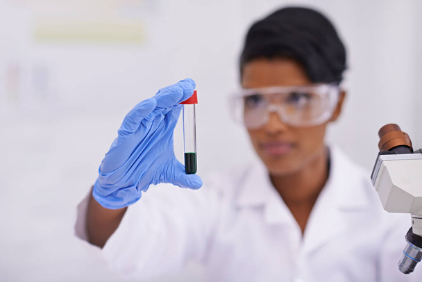 Αίμα, χέρι και επιστήμονας με δοκιμαστικό σωλήνα στο εργαστήριο για επιστημονική έρευνα ή πείραμα. Μικροσκόπιο, επιστήμονας και γυναίκα ερευνητής με φαρμακευτικό DNA σε γυάλινο φιαλίδιο για ιατρική μελέτη - Φωτογραφία, εικόνα