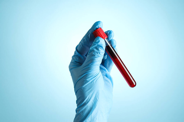 Tubo de ensayo con sangre de donante en la mano del médico sobre fondo azul - Foto, imagen