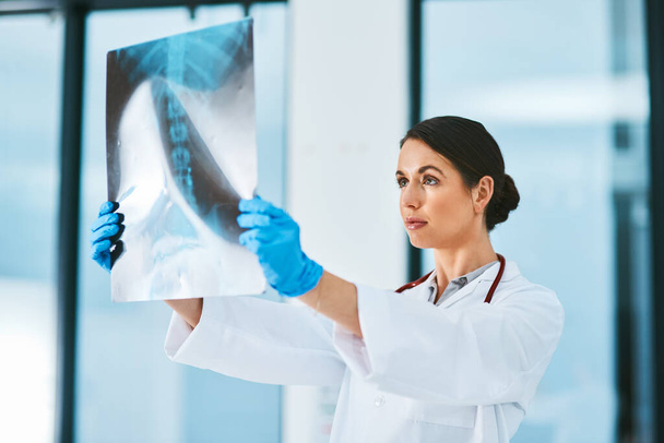 Lääkäri, nainen ja röntgenkuva diagnoosin sairaalan, analyysi ja tarkista tulokset potilaan MRI. Naishenkilö, selkärangan tutkimus ja skannaus tai arviointi, terveydenhuolto ja konsultointi tai tutkimus anatomiaa varten. - Valokuva, kuva