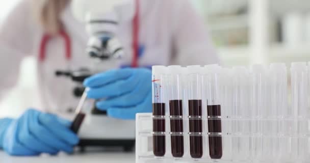 Analisi dei campioni di sangue e diagnosi medica della malattia. Medico che esamina i campioni di sangue dai pazienti - Filmati, video