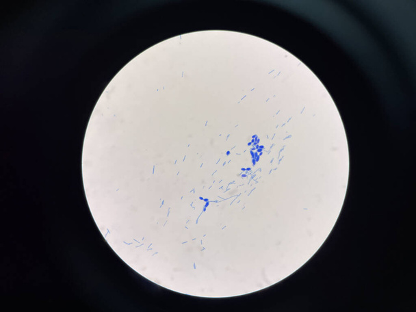 Yeast cell in gram stain. - Photo, Image