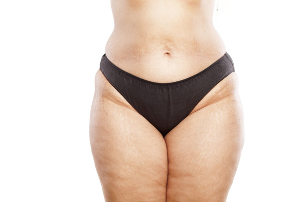 Obézní žena - Fotografie, Obrázek