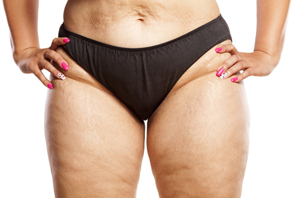Obézní žena - Fotografie, Obrázek