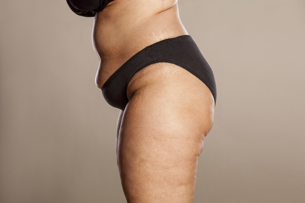 Femme obèse - Photo, image