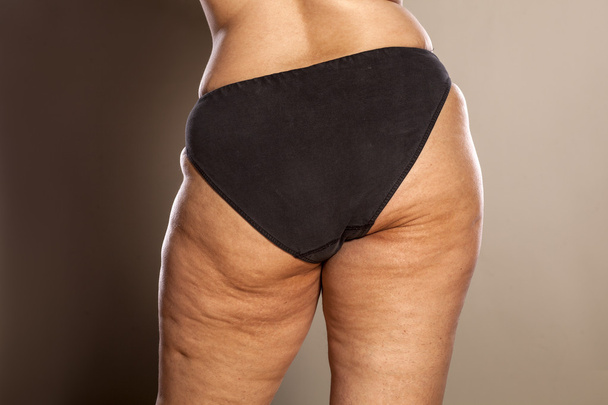 Donna obesa - Foto, immagini