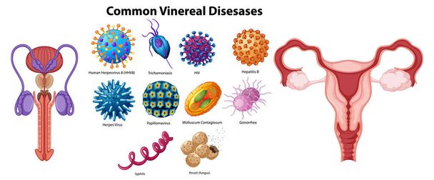 Grafica vettoriale dettagliata di vari agenti patogeni STD - Vettoriali, immagini