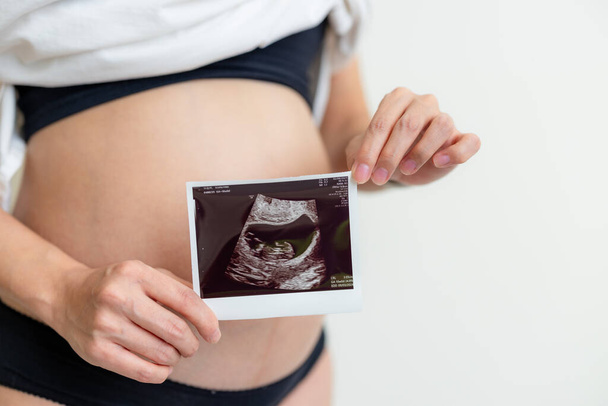 raskaana oleva nainen, jolla on ultraäänikuvaus vatsassaan
 - Valokuva, kuva