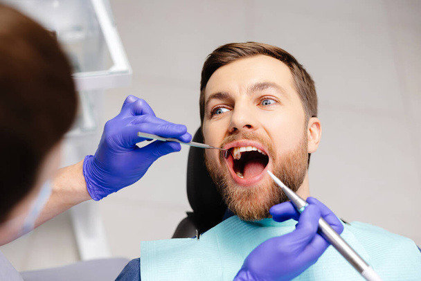 Al hombre le examinan los dientes en los dentistas. Descripción general de la prevención de la caries dental. - Foto, imagen