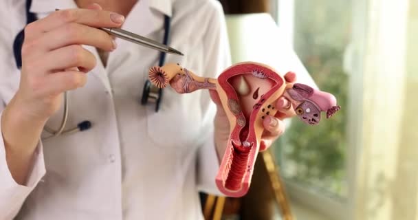 A nőgyógyász tollal mutat a méh és a petefészkek anatómiai modelljére. Az orvos bemutatja a női nemi szervek szerkezetét. - Felvétel, videó