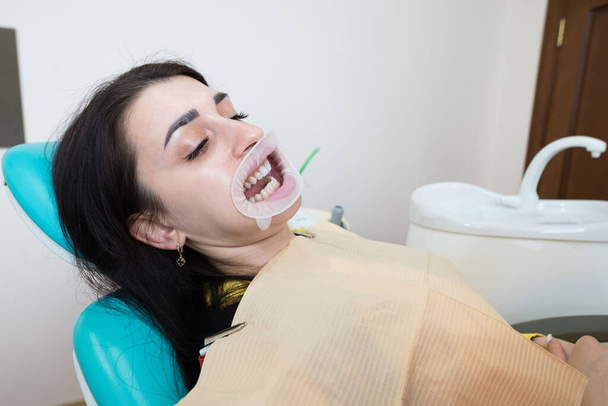 Зубной врач накладывает на пациента шпон. Процесс монтажа. Стоматология, дизайн улыбки, белый зуб. Восстановление зубов. - Фото, изображение