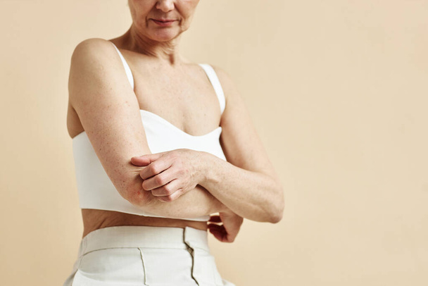 Мінімальний крупний план дорослої жінки, що подряпає голу шкіру, страждає на свербіж або псоріаз, простір для копіювання - Фото, зображення