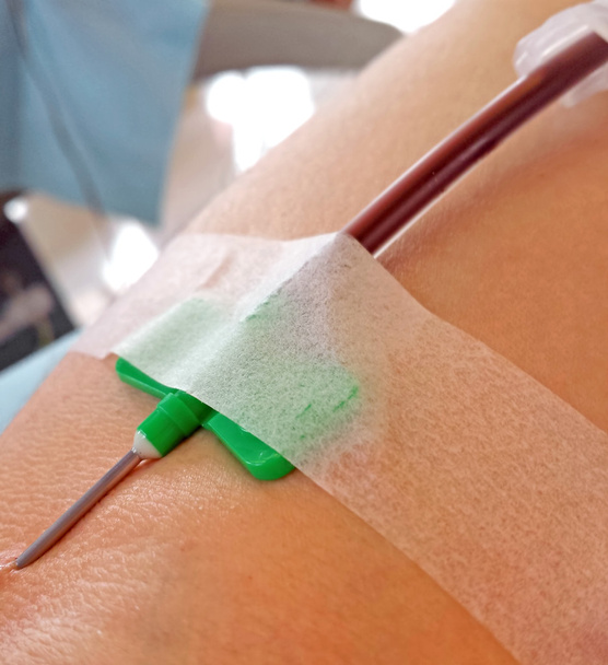 Κατά τη διάρκεια της μετάγγισης αίματος και δωρεά Επίτιμος Αιμοδοτών - Φωτογραφία, εικόνα