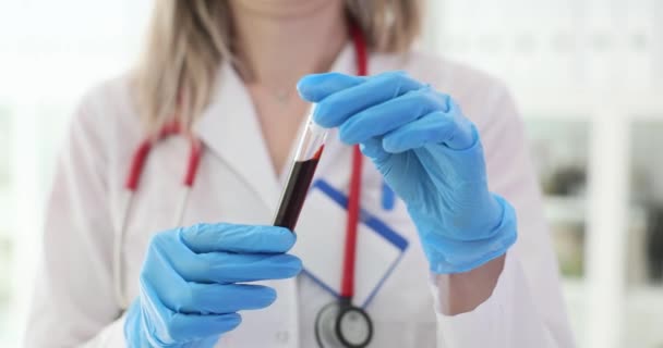 El médico sostiene y observa la muestra de sangre en el tubo de ensayo. Examen clínico de sangre y control de salud - Imágenes, Vídeo