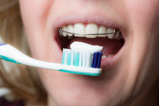 Nettoyage des dents avec un appareil dentaire
 - Photo, image
