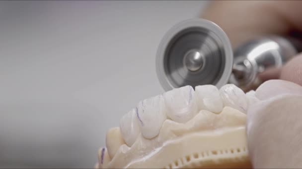 Reducing and Rounding of Bordered Implant Zirconium Prosthesis Teeth with Milling Footage. - Imágenes, Vídeo
