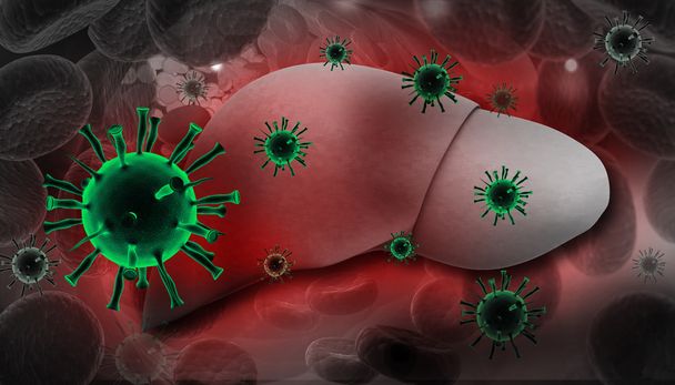 Leberinfektion mit Hepatitis-Viren - Foto, Bild