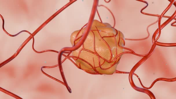 3d animatie van kanker vereist een bloedtoevoer naar de voedingsstoffen en zuurstof die het nodig heeft om te groeien en te overleven leveren - Video